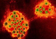 norovirus-virus-particle-microscope