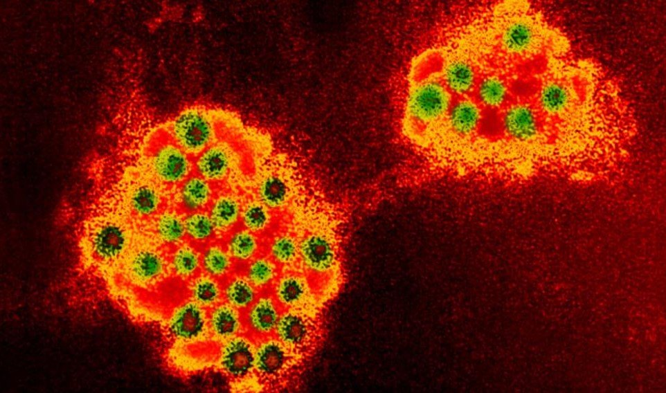 norovirus-virus-particle-microscope