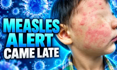 Asheville hotel measles notice after guests left