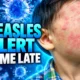 Asheville hotel measles notice after guests left